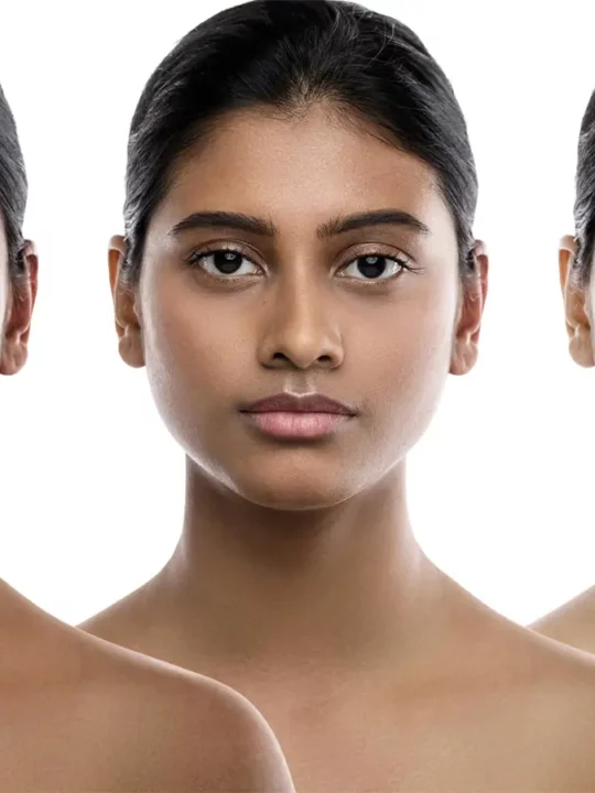 5 Things You Should Know About Visible Pores Areas of My Expertise